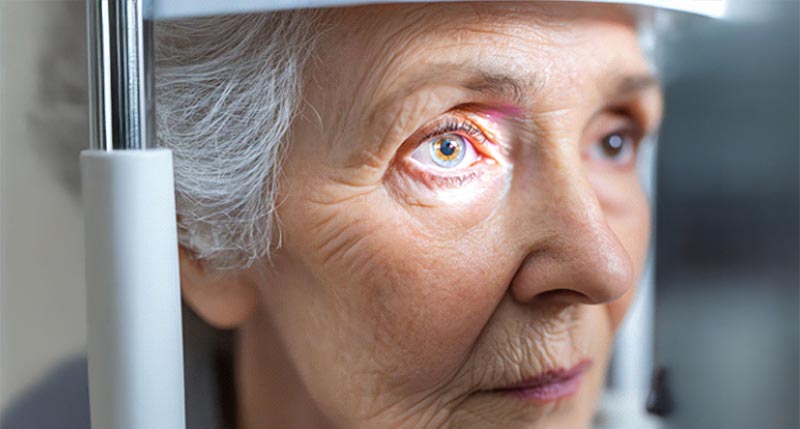 5 Facts to Know About Glaucoma